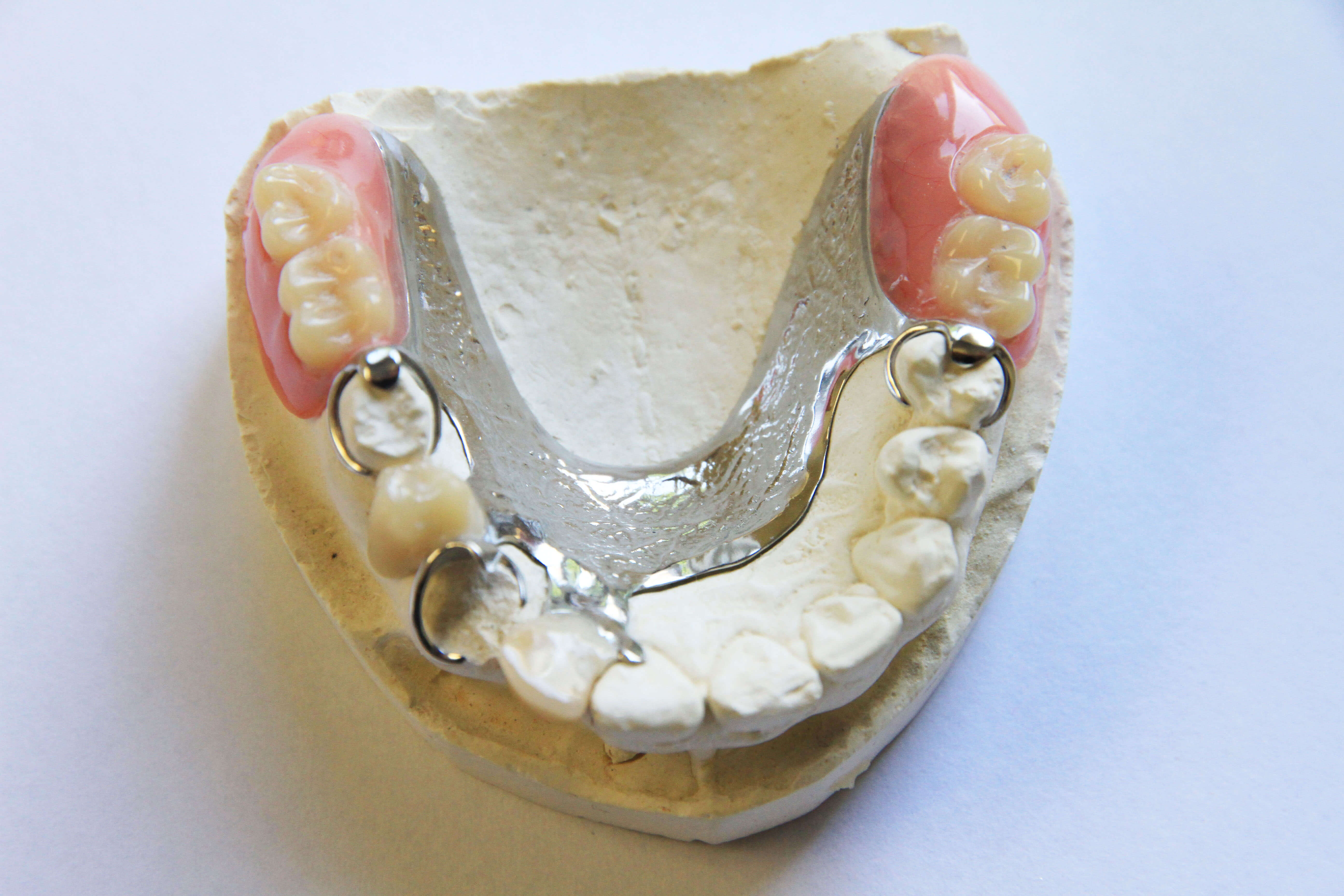 Prothèse dentaire  partielle - Dentiste Touchette à Gatineau
